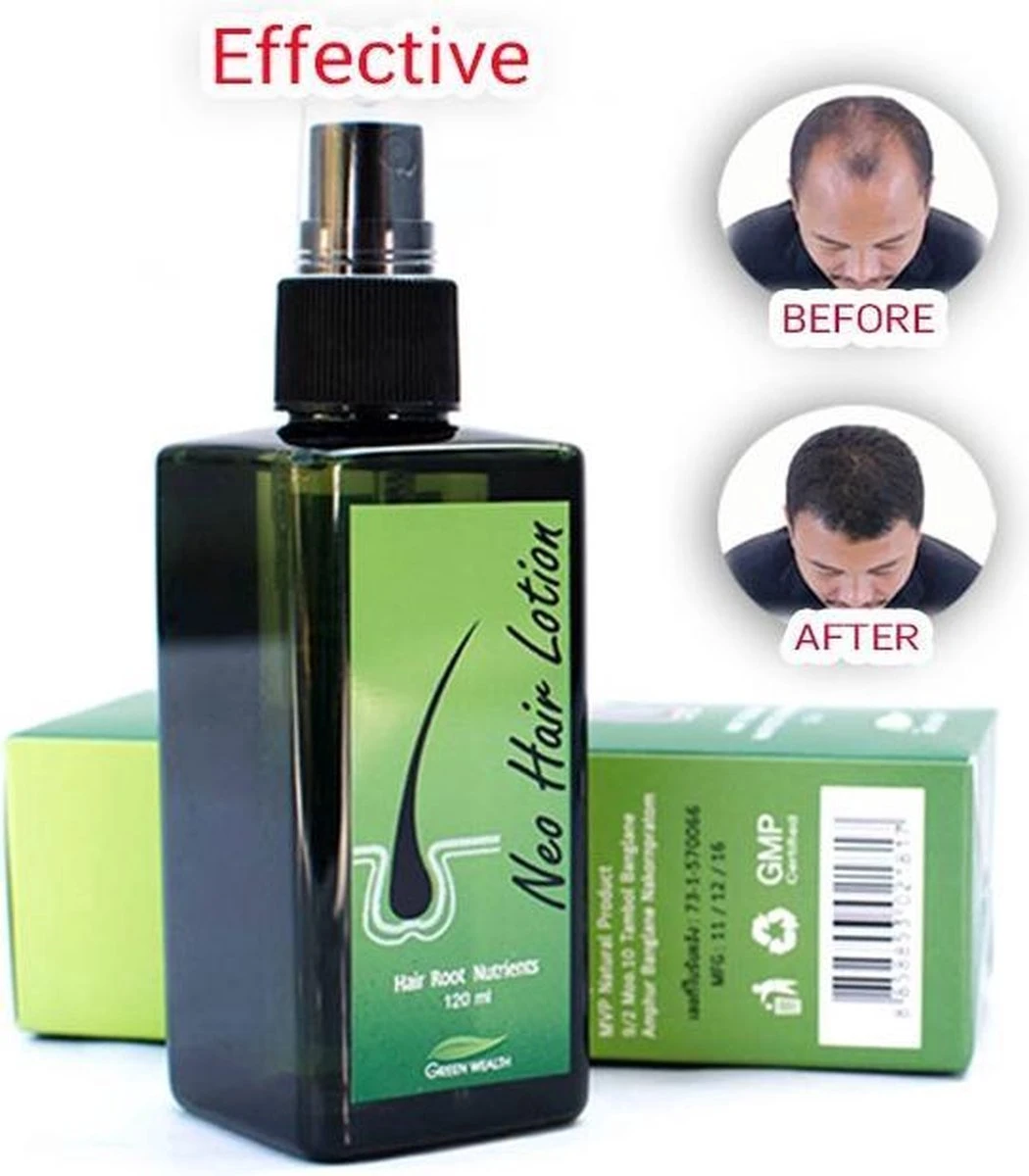 Green Wealth Neo Hair Lotion - Neo Hair Lotion Origineel - Original - Anti Haaruitval - Haargroeiproducten 2 Green Wealth Neo Hair Lotion - Neo Hair Lotion Origineel - Original - Anti Haaruitval - Haargroeiproducten - Afbeelding 2