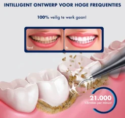 DynaBright Elektrische Tandsteen Verwijderaar - 5 Standen - 5 Delig - Incl. Professionele Tandarts Set - Tandplak - Zwart - Tong Schraper - USB - Tand Verzorging -Oral B Shop 1200x1136 1
