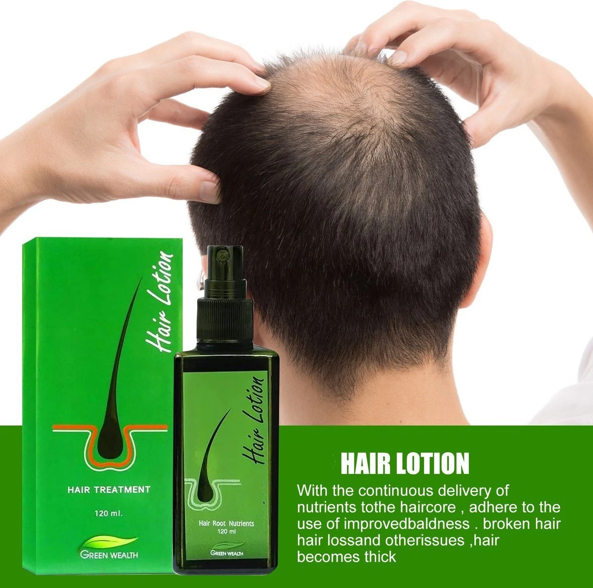 Green Wealth Neo Hair Lotion - Neo Hair Lotion Origineel - Original - Anti Haaruitval - Haargroeiproducten 5 Green Wealth Neo Hair Lotion - Neo Hair Lotion Origineel - Original - Anti Haaruitval - Haargroeiproducten - Afbeelding 5
