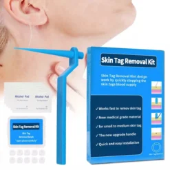 Steelwratjes Verwijderaar - Steelwratjes Verwijderen - Pijnloos En Snel - Wrattenverwijderaar - Steelwratten