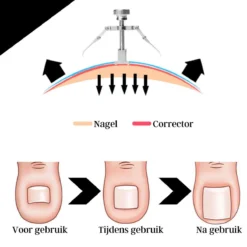 7-delige Pedicure En Manicure Set - Nagelknipper - Pedicureset - Nagelvijl - Nageltang - Kalknagel - Teennagelknipper -Oral B Shop 1200x1200 1193