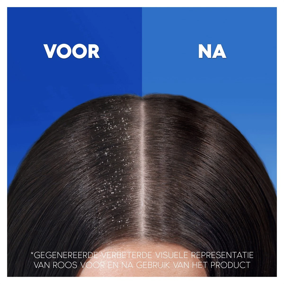 Head & Shoulders Intense Hydration - Anti-roos - Conditioner - Verhoogde Anti-roos Bescherming - 6 X 220ml 6 Head & Shoulders Intense Hydration - Anti-roos - Conditioner - Verhoogde Anti-roos Bescherming - 6 X 220ml - Afbeelding 6