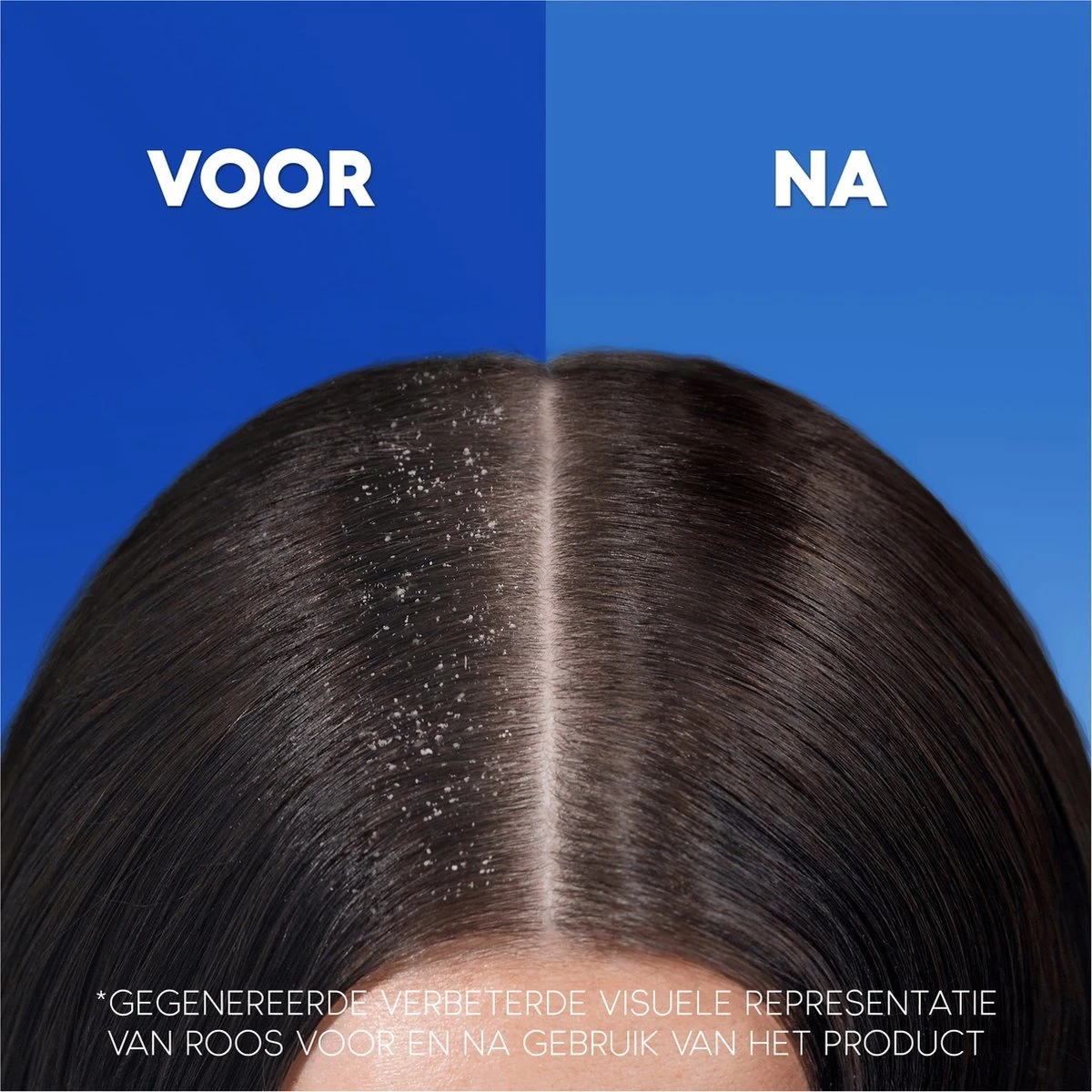 Head & Shoulders Menthol Fresh - Anti-roos Shampoo - Tot 100% Roosvrij - Voordeelverpakking 6 X 285 Ml 5 Head & Shoulders Menthol Fresh - Anti-roos Shampoo - Tot 100% Roosvrij - Voordeelverpakking 6 X 285 Ml - Afbeelding 5