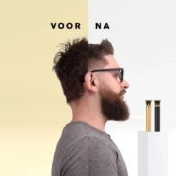 Alternative view of VRL Tondeuse – Trimmer Voor Mannen – Baard – Haartrimmer – Tondeuse Mannen Hoofdhaar – 0 Tot 9 Millimeter