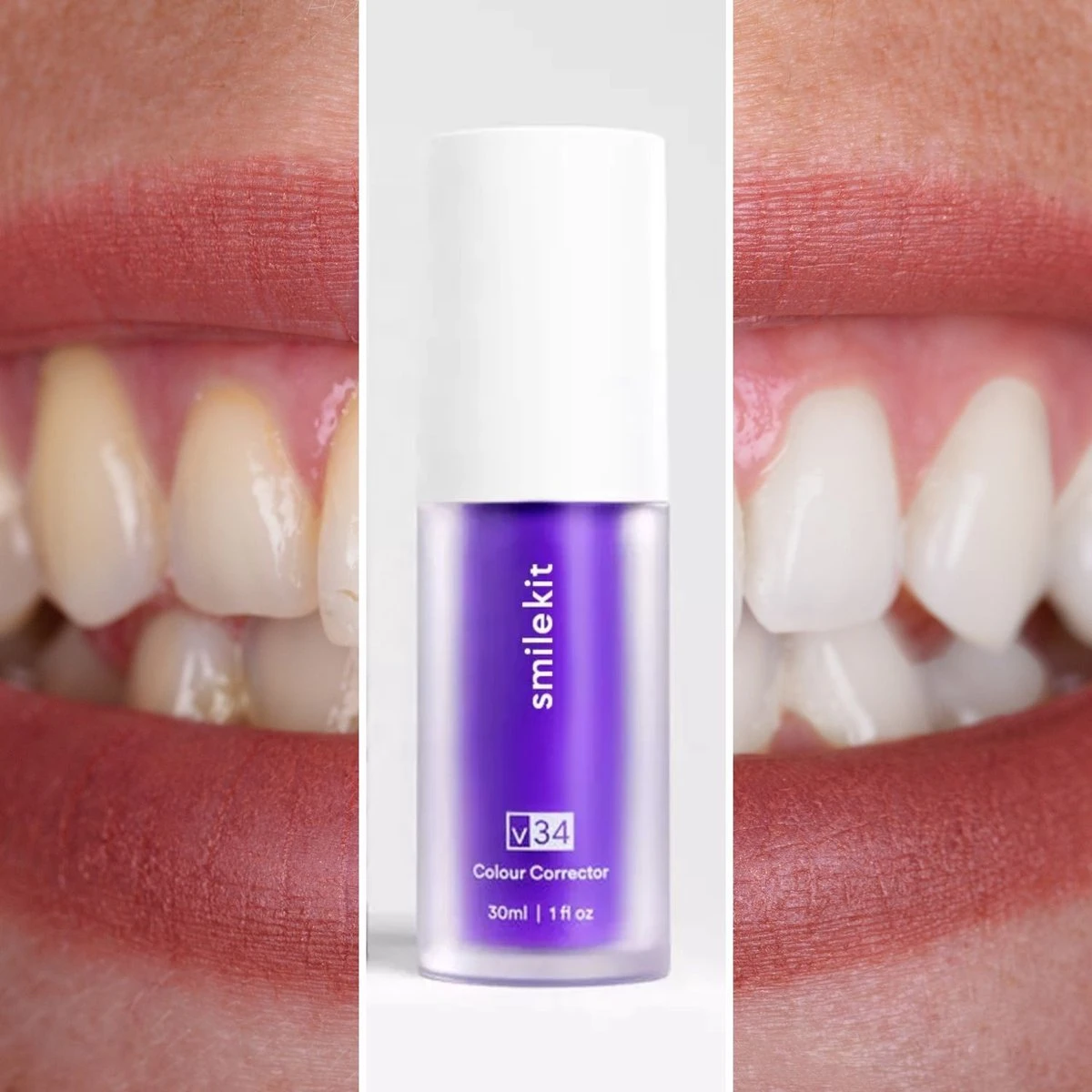 Witte Tanden Kleur Corrector - Superdeal - 1 + 1 GRATIS - Kleur Tanden Wit Door Te Poetsen Thuis - Tanden Bleken - Tanden Witte - Foam Voor Witte Tanden 5 Witte Tanden Kleur Corrector - Superdeal - 1 + 1 GRATIS - Kleur Tanden Wit Door Te Poetsen Thuis - Tanden Bleken - Tanden Witte - Foam Voor Witte Tanden - Afbeelding 5
