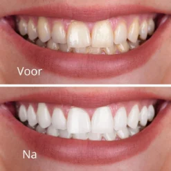 Witte Tanden Kleur Corrector - Superdeal - 1 + 1 GRATIS - Kleur Tanden Wit Door Te Poetsen Thuis - Tanden Bleken - Tanden Witte - Foam Voor Witte Tanden 14 Witte Tanden Kleur Corrector - Superdeal - 1 + 1 GRATIS - Kleur Tanden Wit Door Te Poetsen Thuis - Tanden Bleken - Tanden Witte - Foam Voor Witte Tanden -Oral B Shop 1200x1200 504